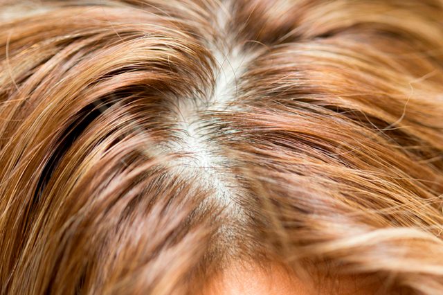 01-7 Super-Damaging Hair Combing Mistakes You Don't Even Know You're Making_564109834