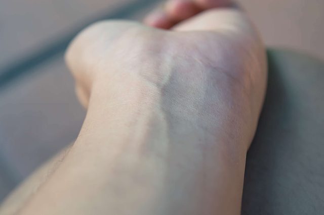 arm