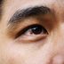 This Is What It Could Mean if You Have a Red Spot on Your Eye