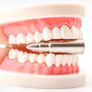 Model teeth grip a metallic bullet, set in a white background.