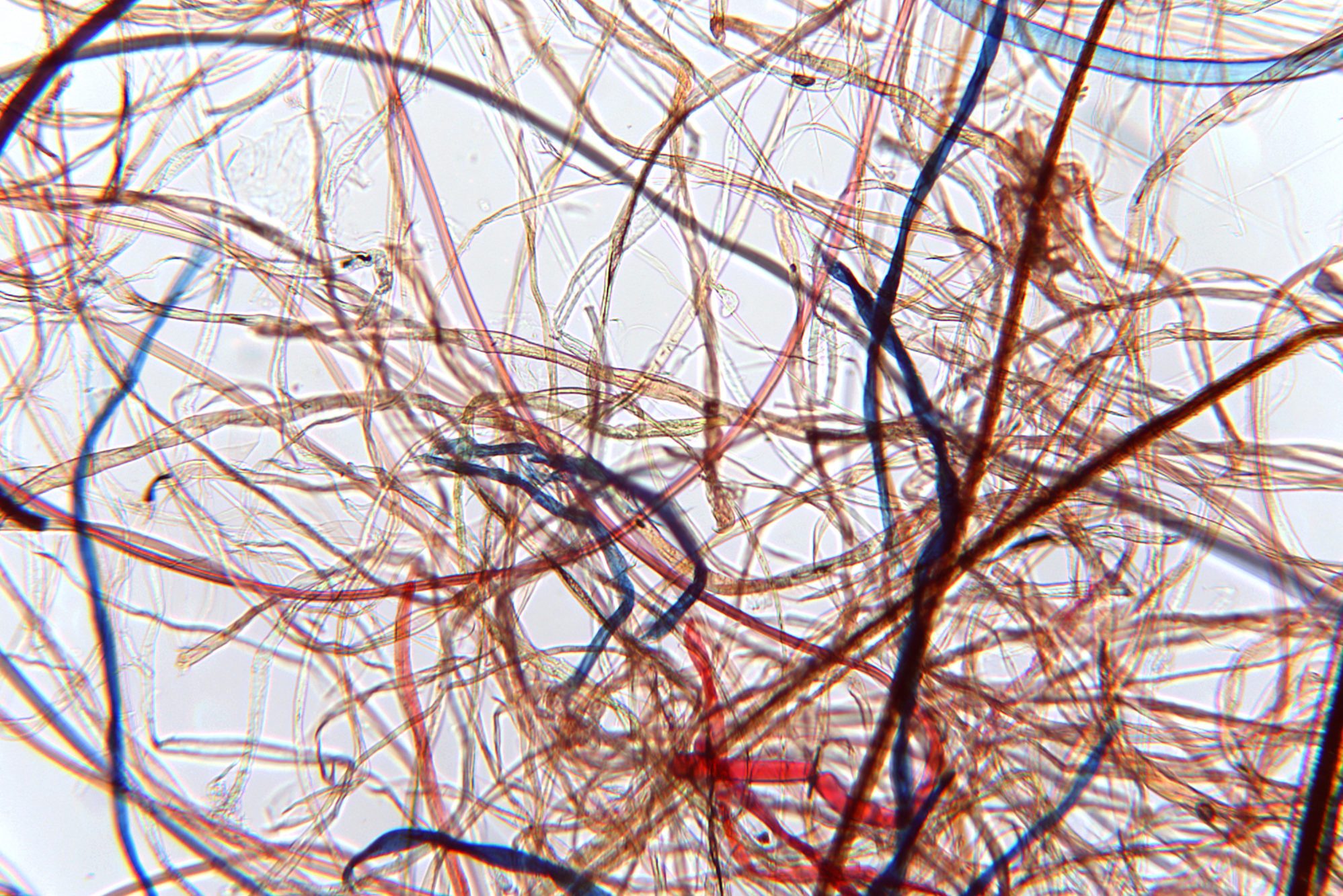 Dust Bunny under the microscope