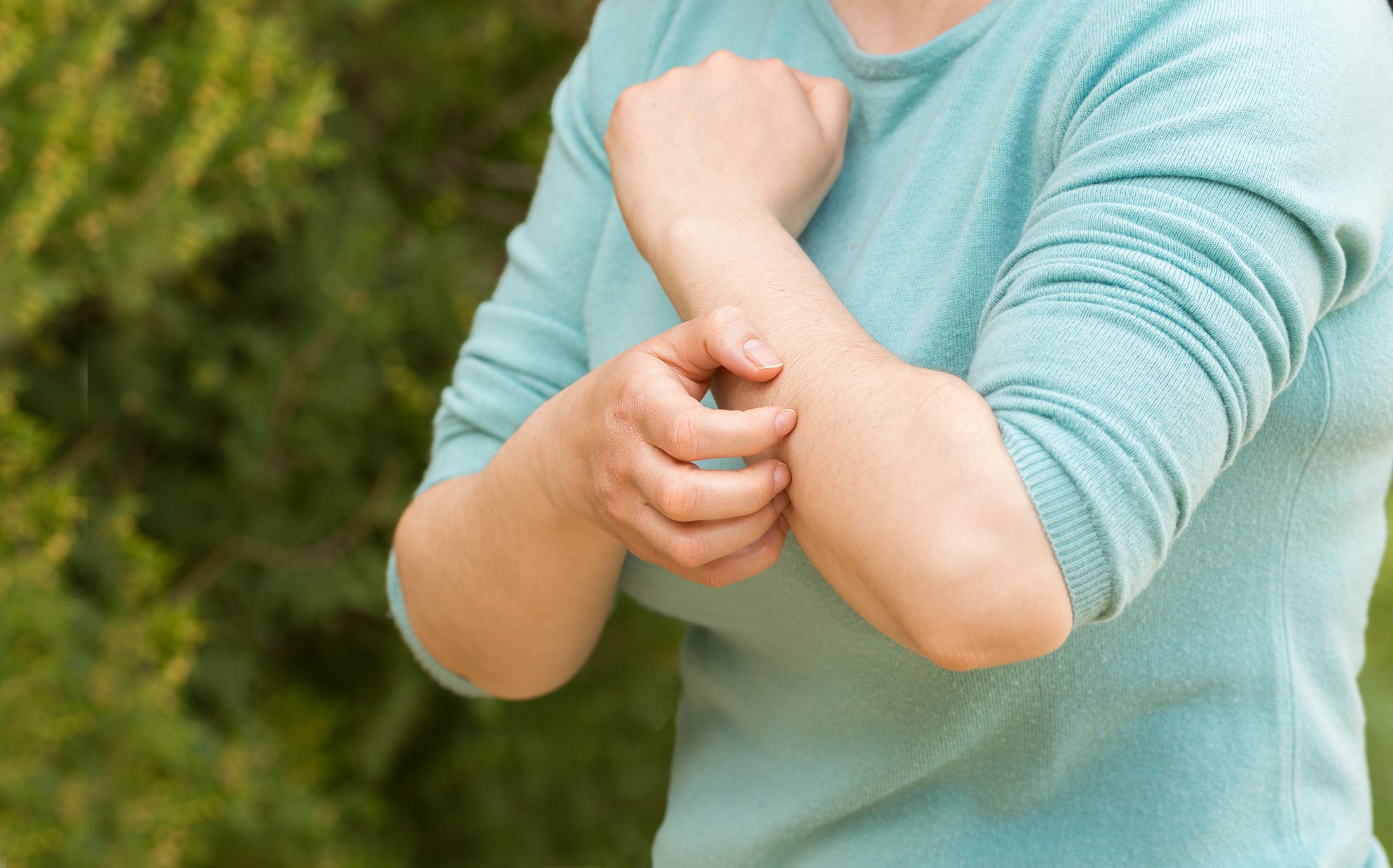 woman scratching her arm